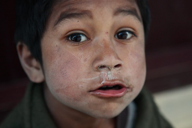 Фото 5 Фото 5