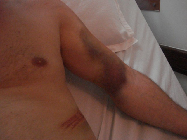 Фото 7 Фото 7